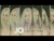 JO – Iubirea mea (Original Radio Edit)
